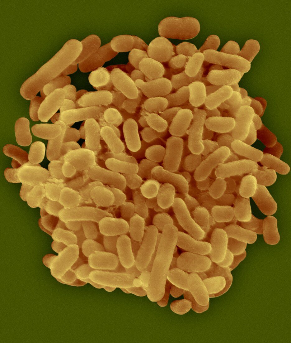 Oral bacterium, Porphyromonas gingivalis, SEM