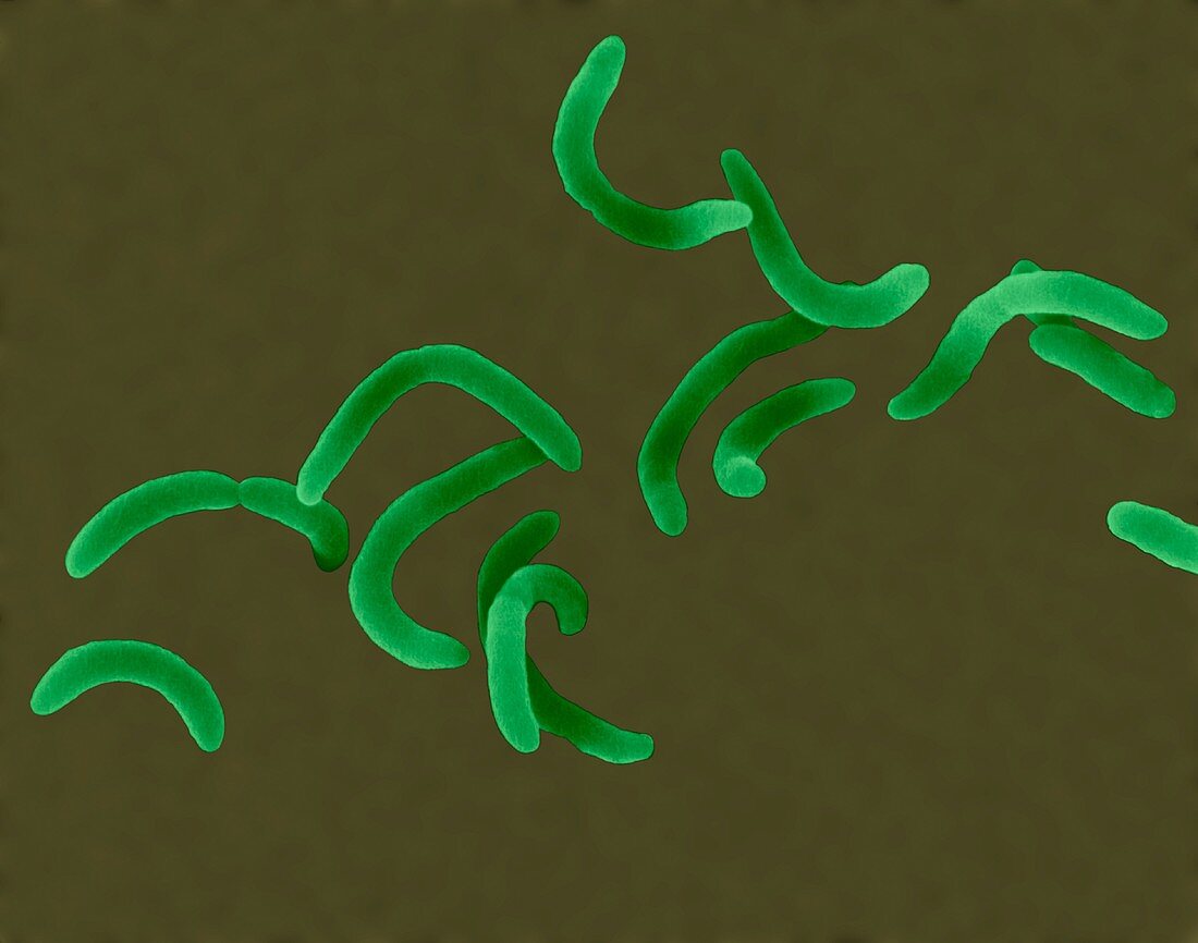 Vibrio cholerae -curved rod prokaryote, SEM