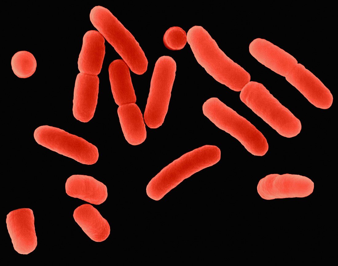 E. coli, SEM