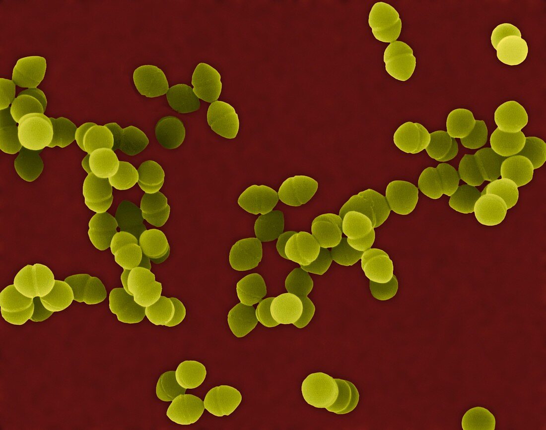 Enterococcus faecium, SEM