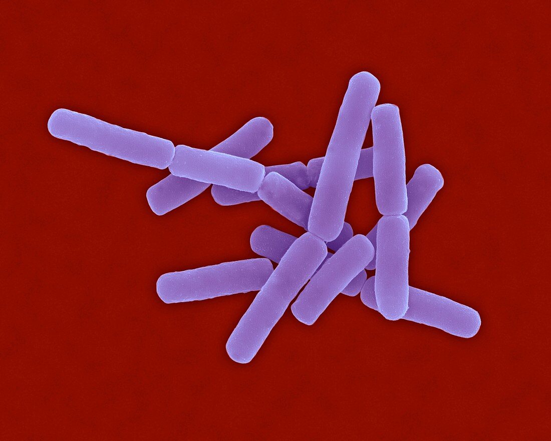 Bacillus anthracis, bacterium, SEM