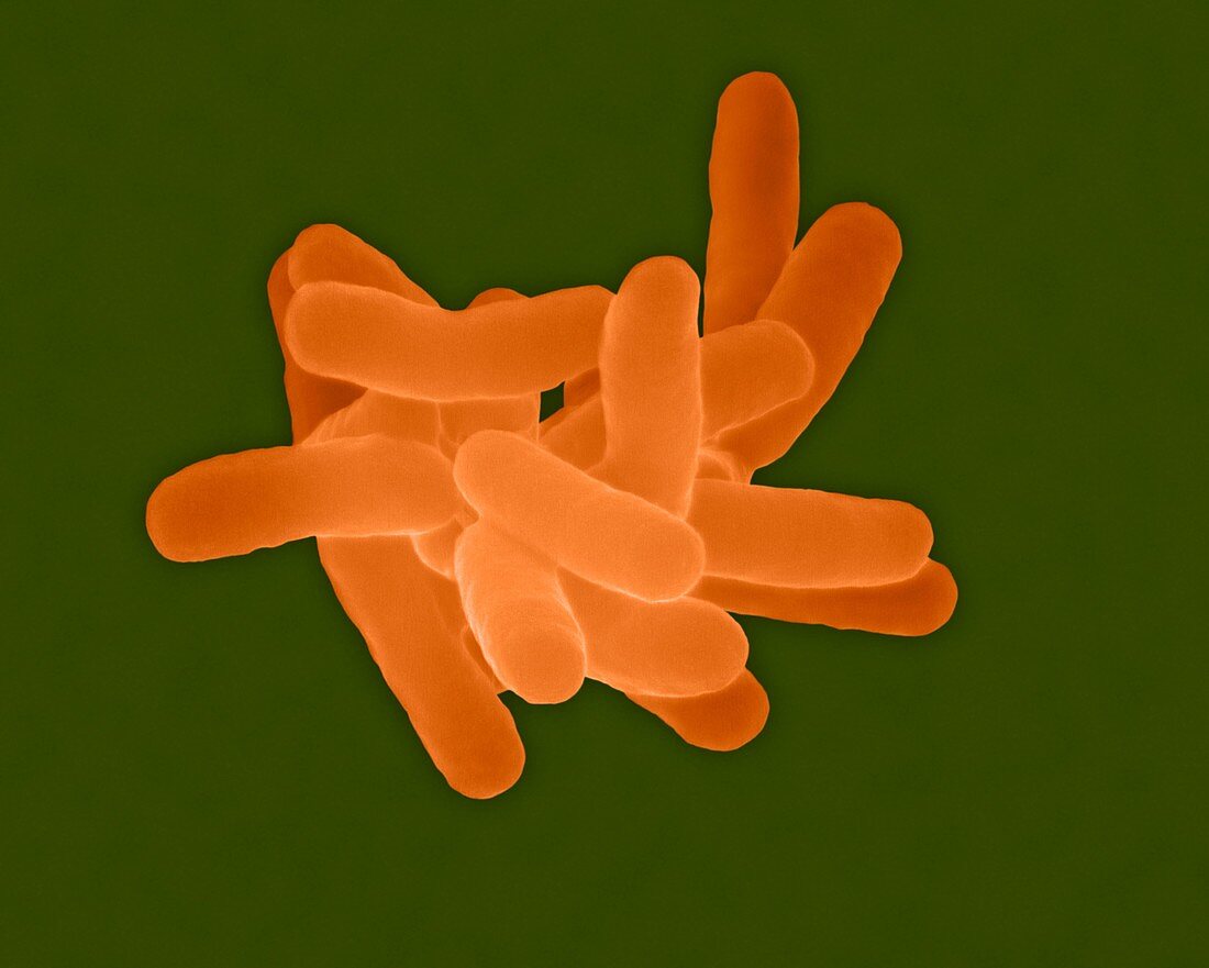 Tatlockia micdadei, bacterium, SEM