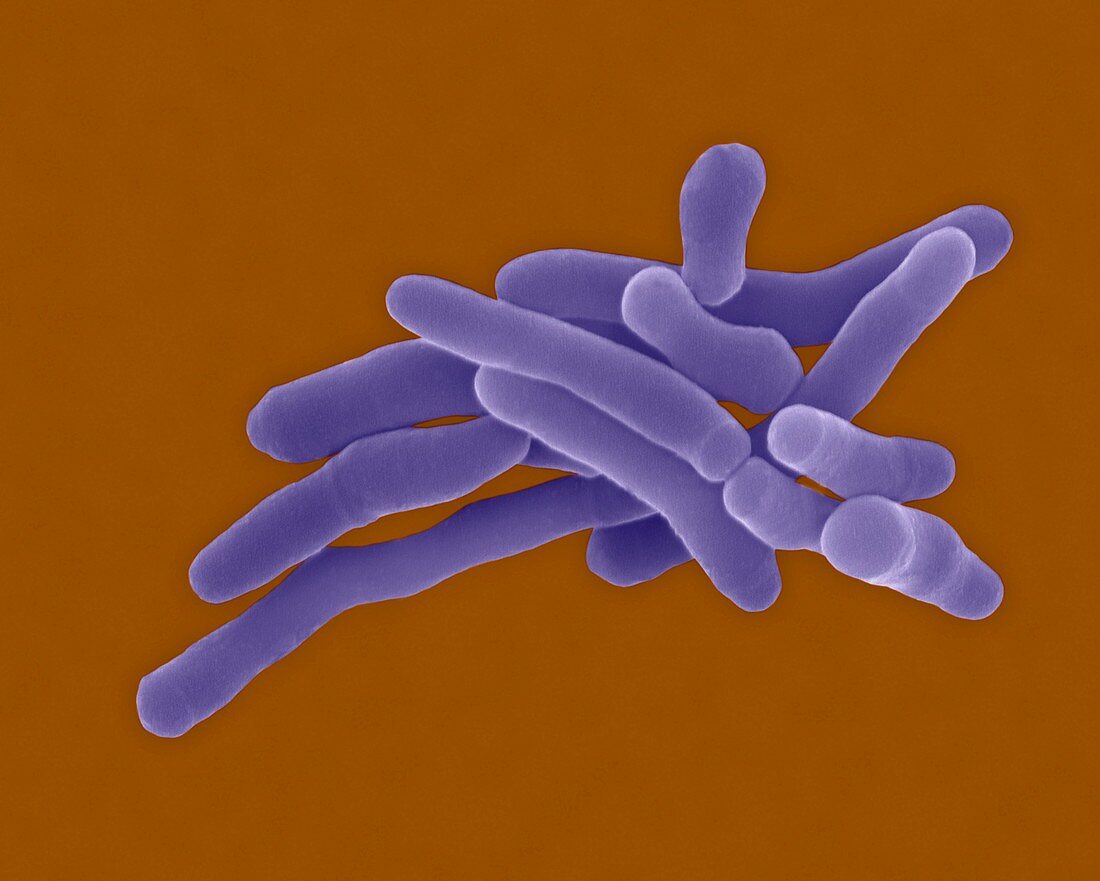 Rhodococcus fascians, bacterium, SEM