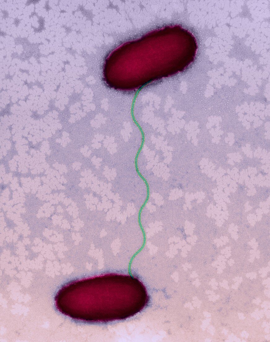 E. coli conjugation, TEM
