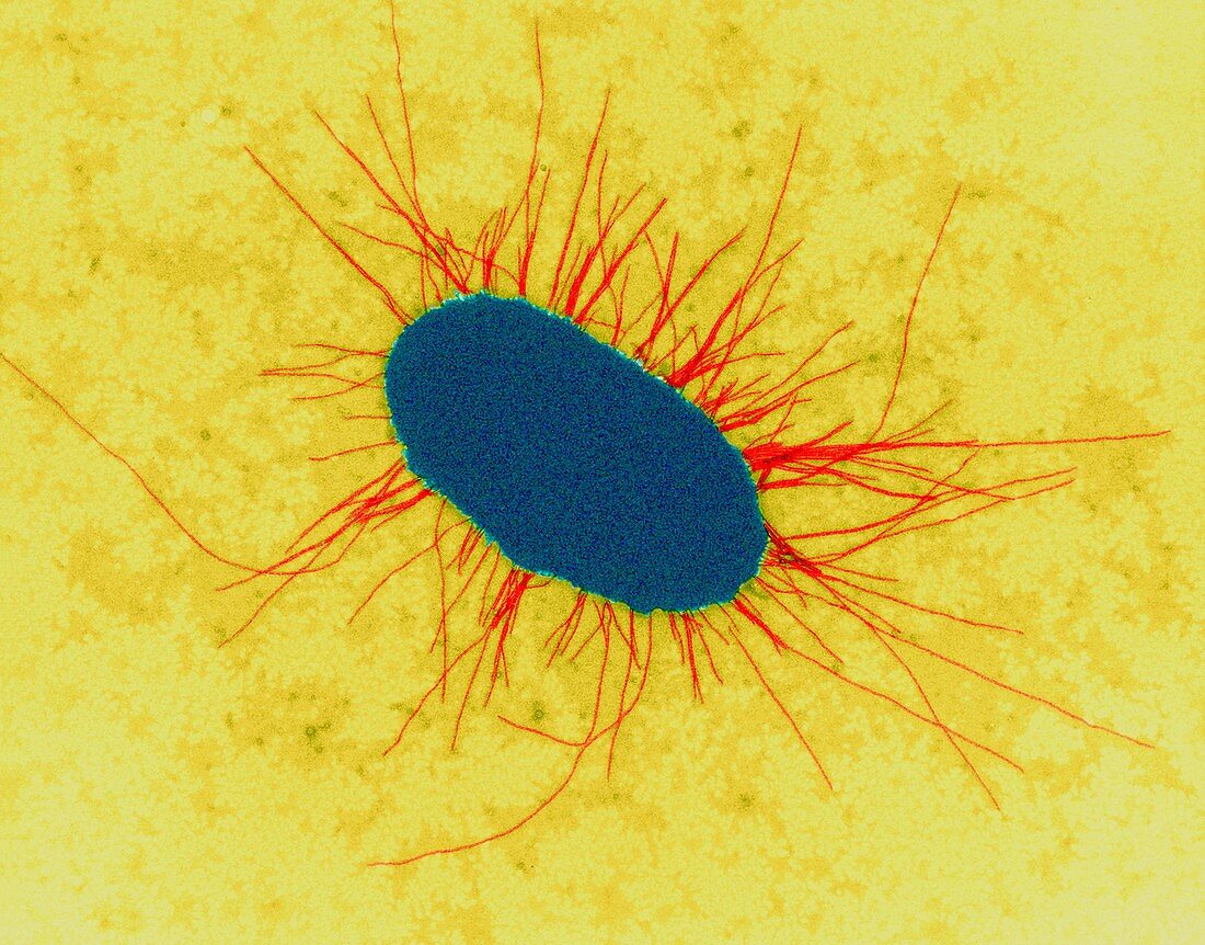 E. coli with fimbriae, TEM
