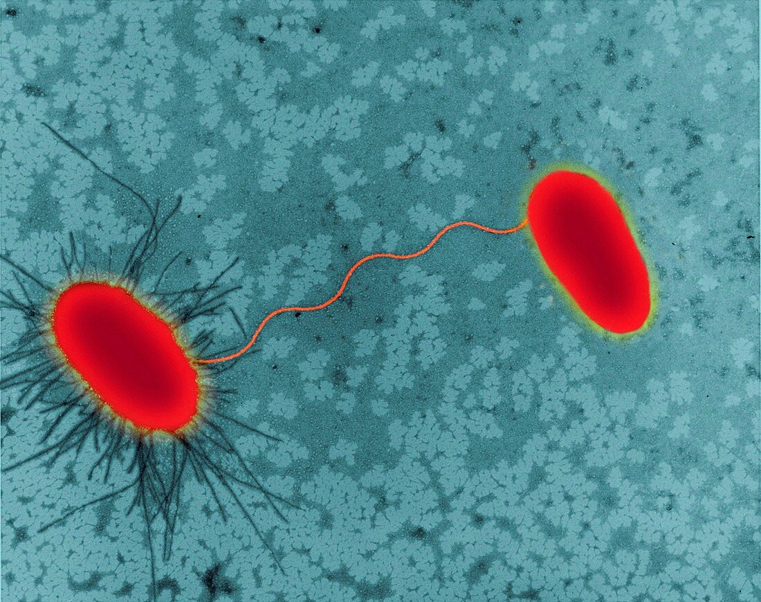 E.coli conjugation, bacterium, TEM