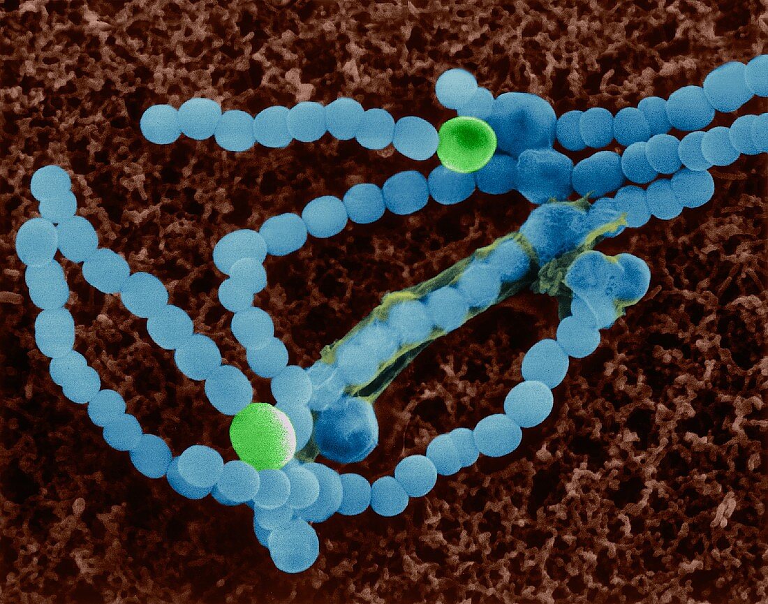 Cyanobacterium (Anabaena sp.), SEM