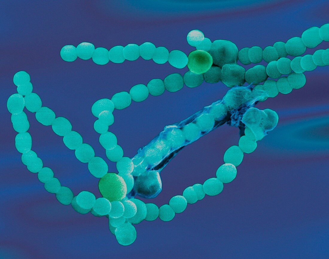 Cyanobacterium (Anabaena sp.), SEM