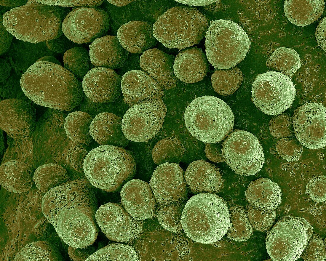 Crustose lichen (Xanthoparmelia sp.), SEM