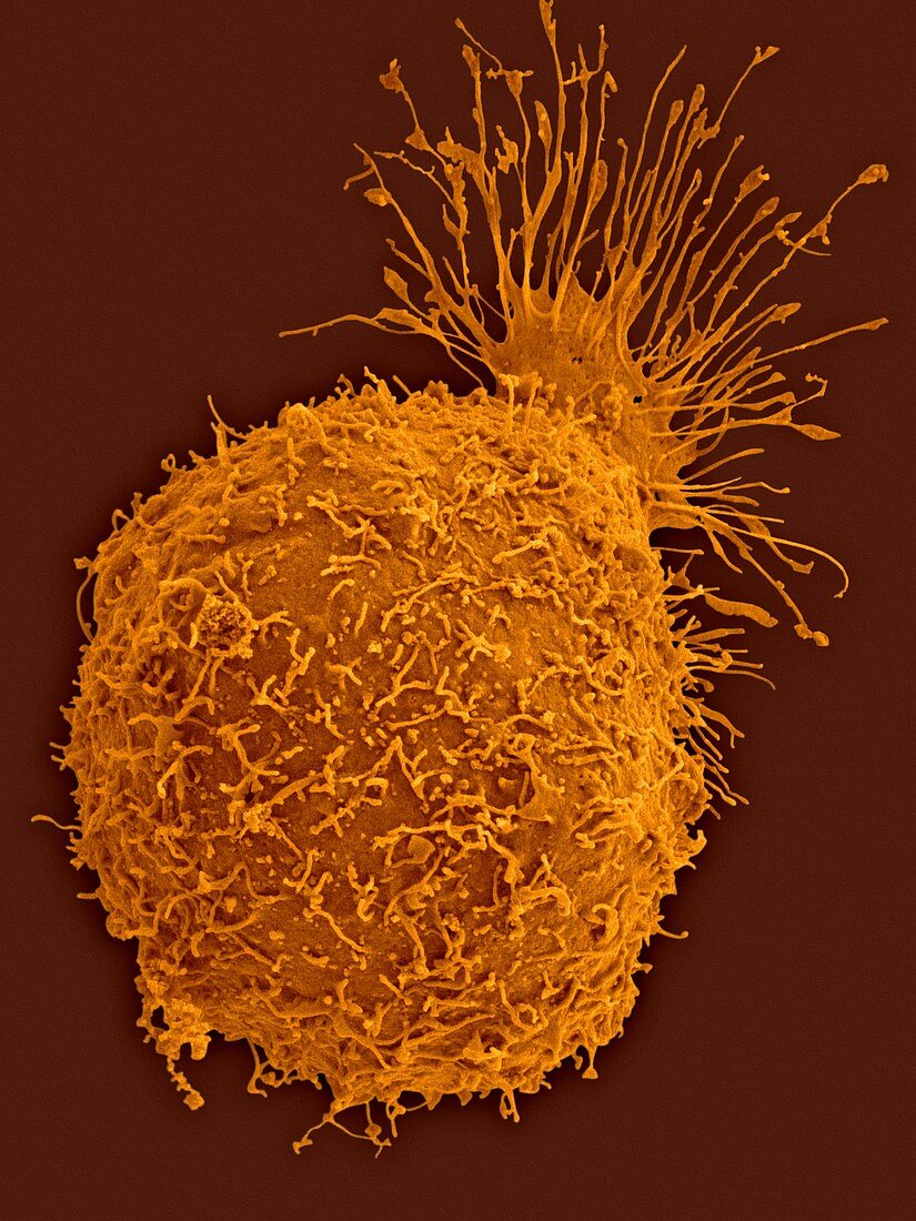 Insect ovary cell, SEM