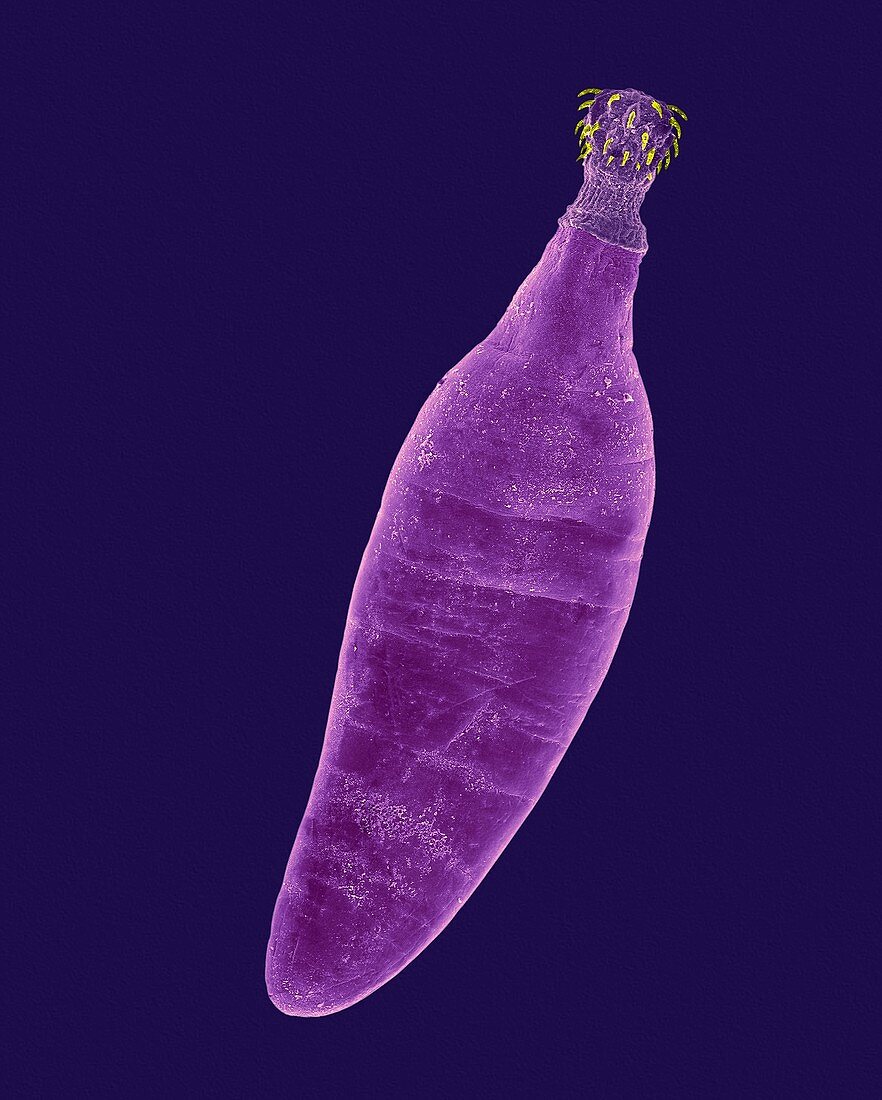 Thorny-headed worm (Oncicola canis), SEM