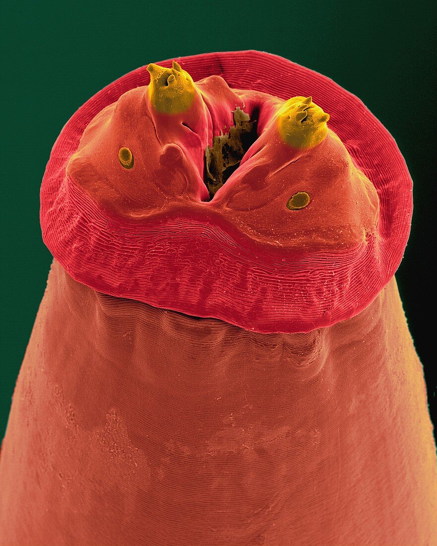 Raccoon intestinal roundworm, SEM