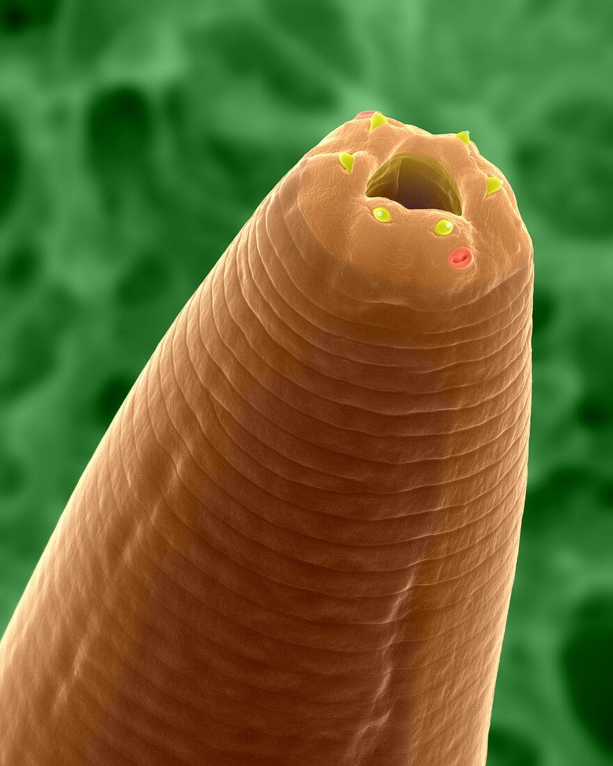 Soil nematode stomodeum (Caenorhabditis elegans), SEM