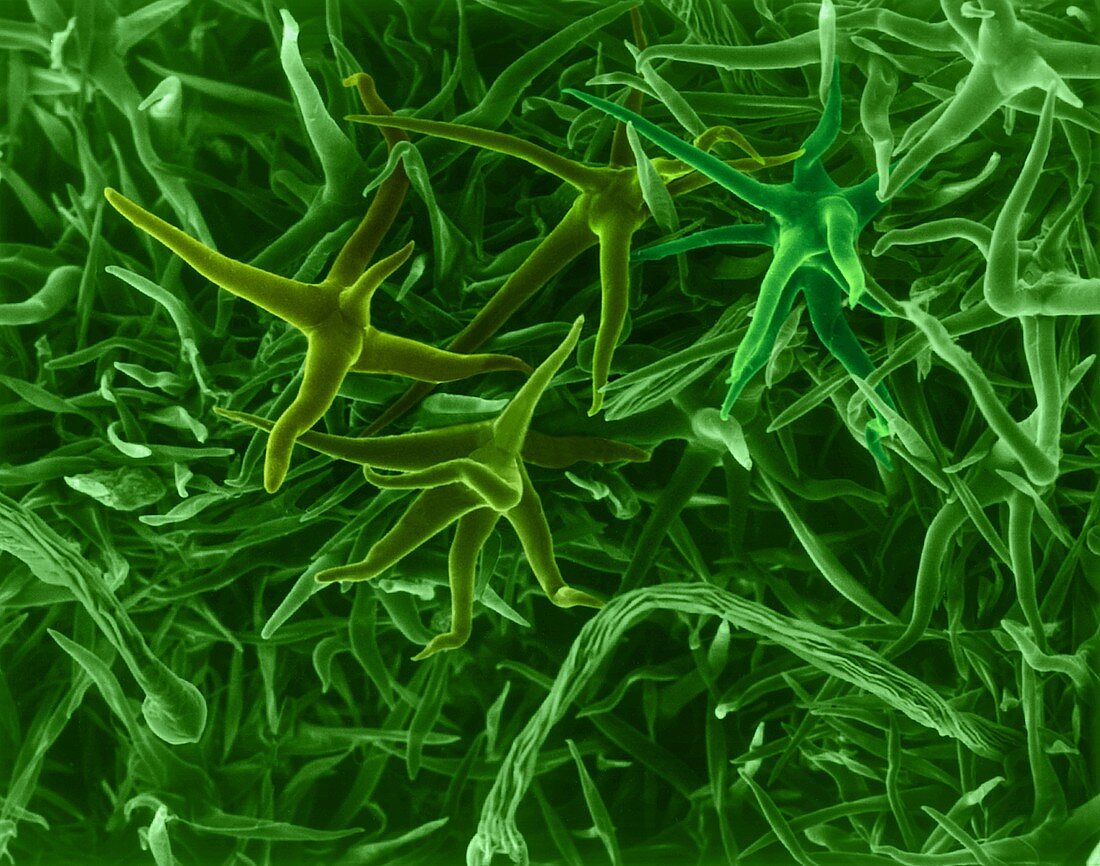 Leaf surface showing branched hairs, SEM