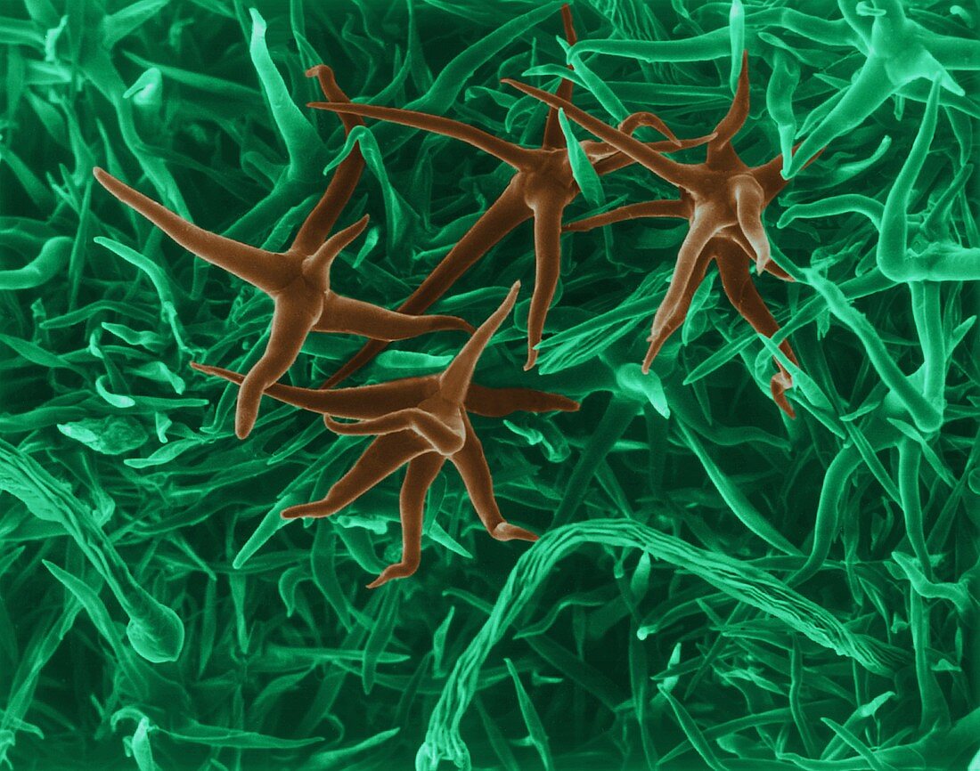 Leaf surface showing branched hairs, SEM
