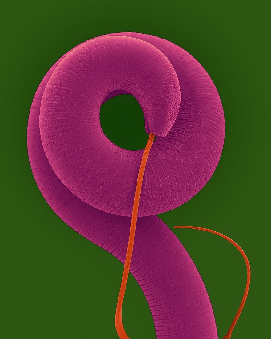 Nematode (Trichuris spp.) helminth (whipworm), SEM