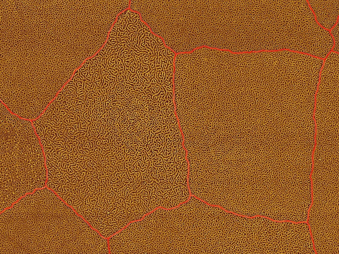 Frog tympanum cell surface, SEM