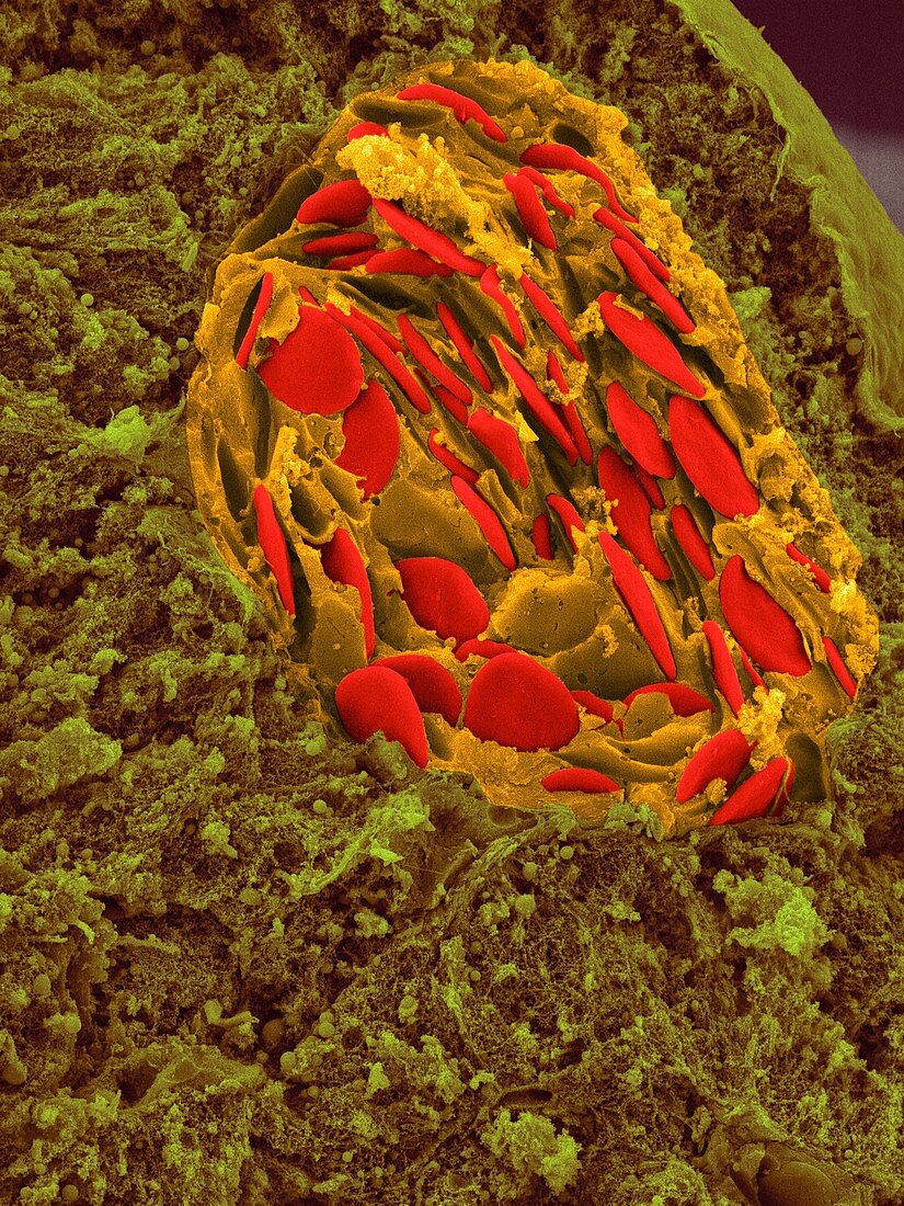 Frog blood in liver blood vessel, SEM