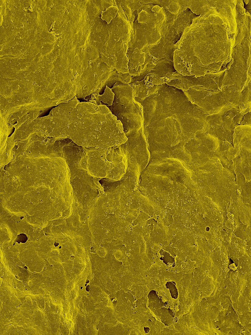 Lemon Peel Surface, SEM