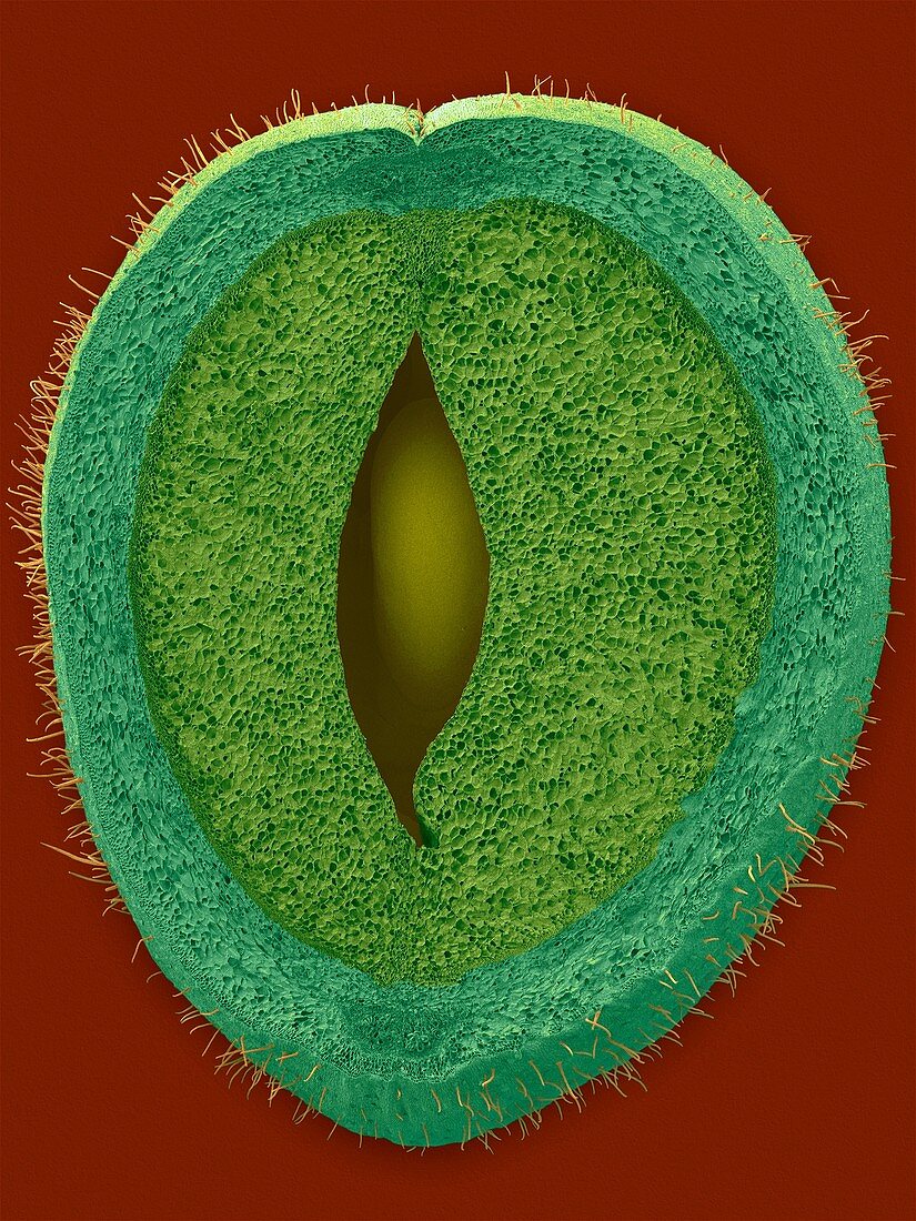 Green bean parenchyma cells and seed, SEM