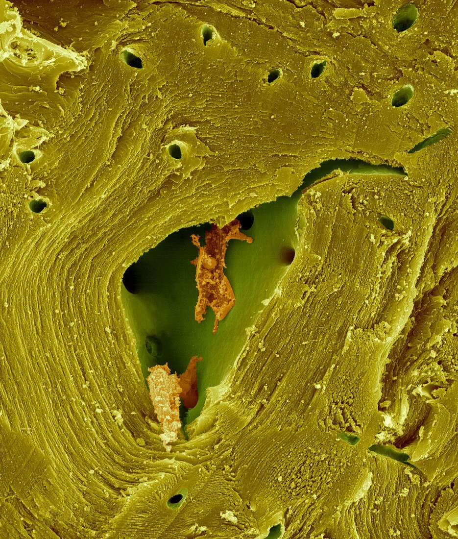 Pear sclereid or stone cell (Pyrus sp.), SEM