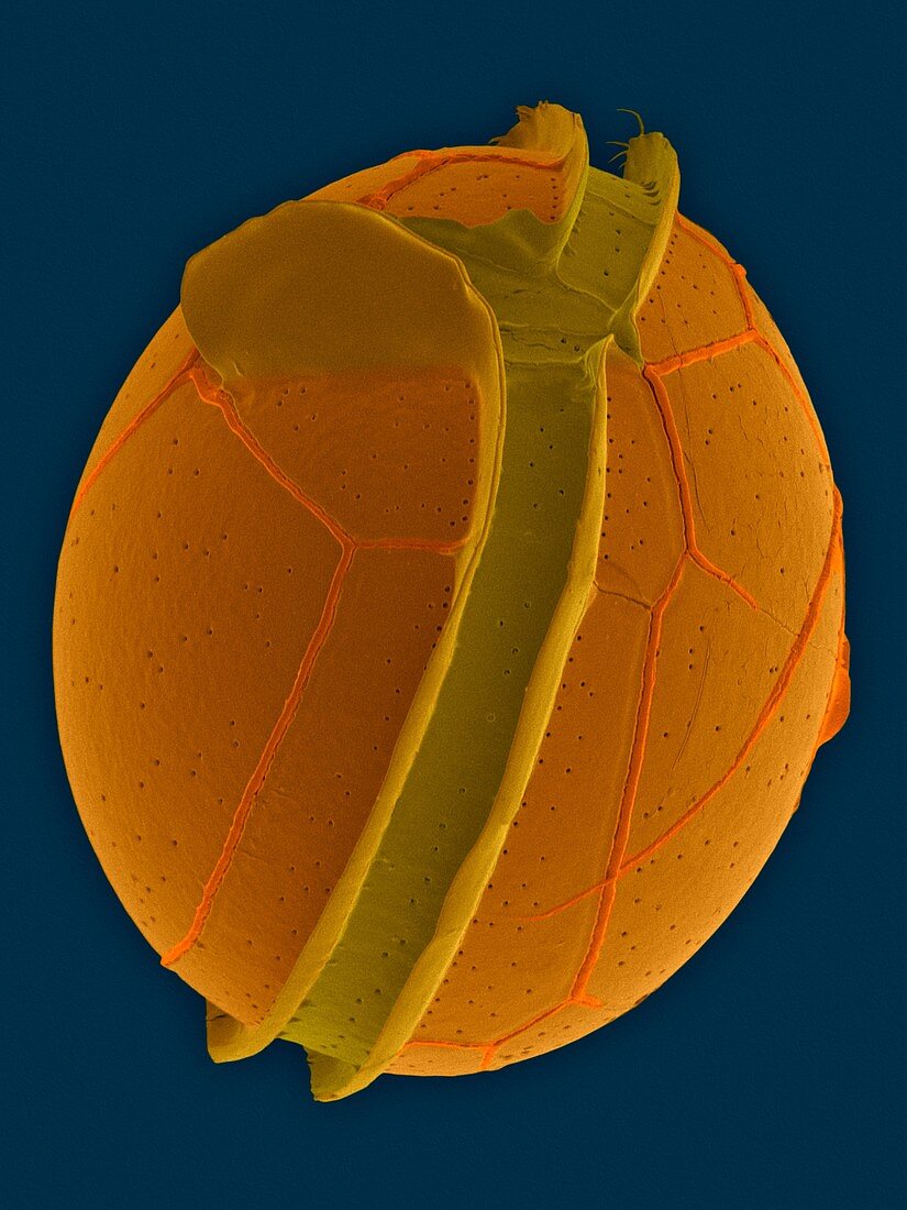 Protoperidinium dinoflagellate, SEM