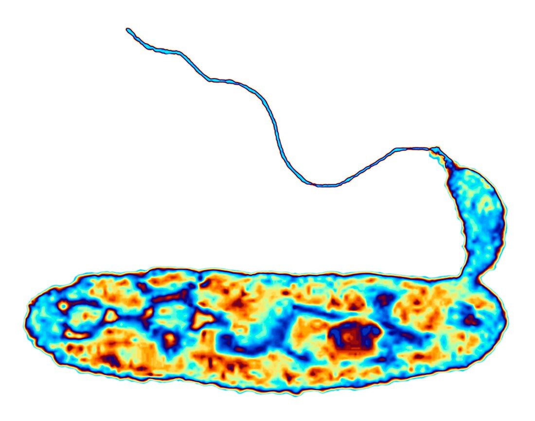 Bacteria (Bdellovibrio bacteriovorus)