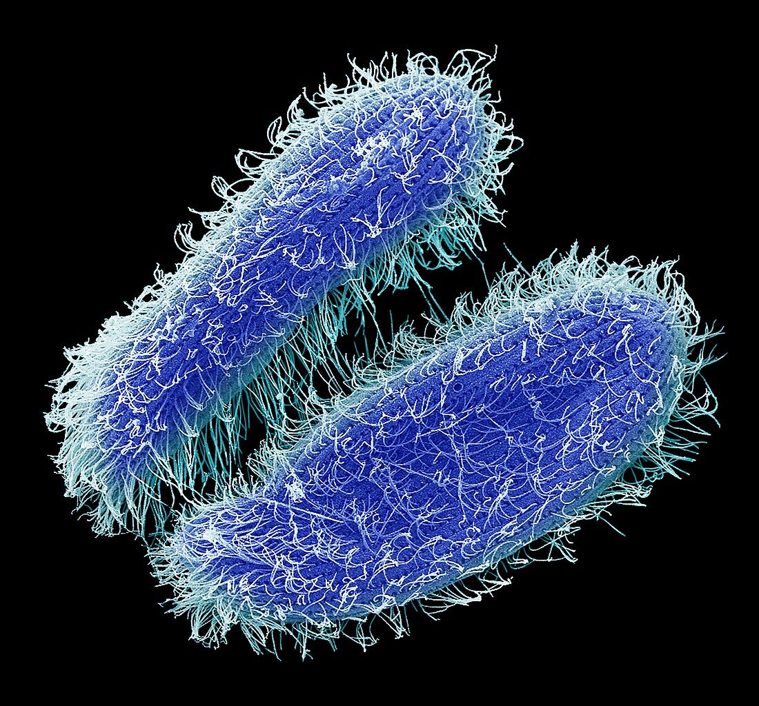 Paramecium protozoa, SEM