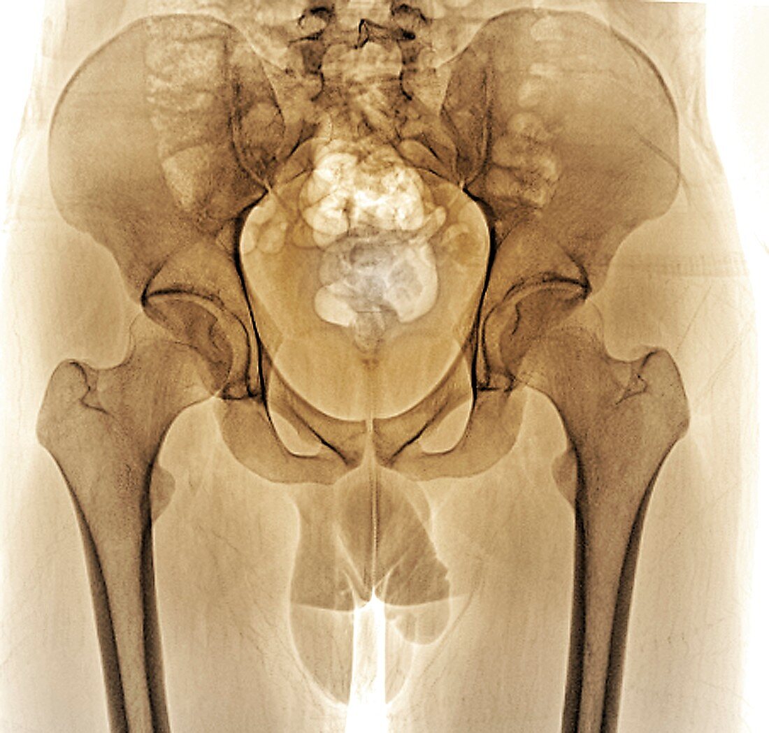 Male pelvis bones and joints, X-ray