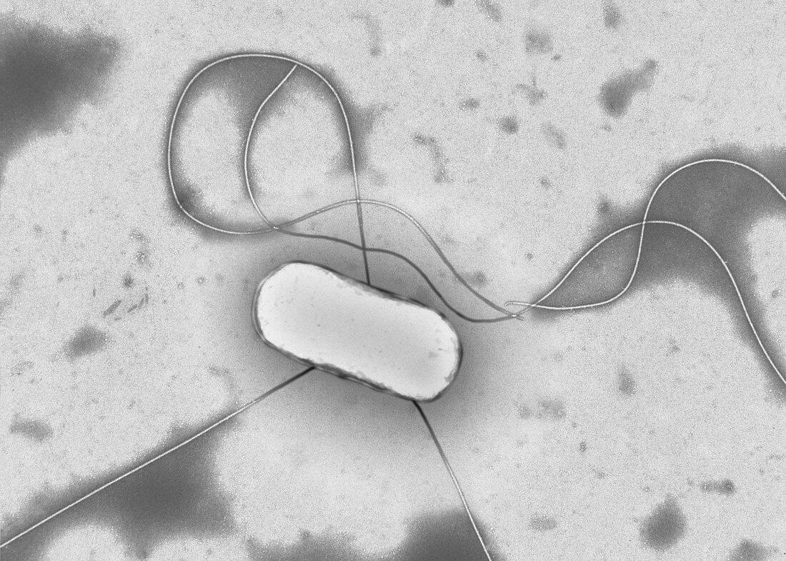 E. coli bacterium, TEM