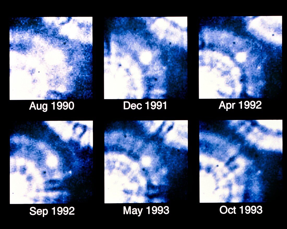 Ultraviolet HST images of supernova SN 1987A