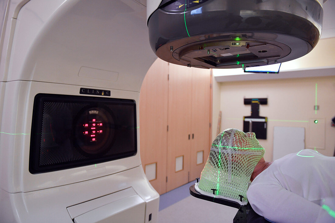 Brain cancer radiotherapy