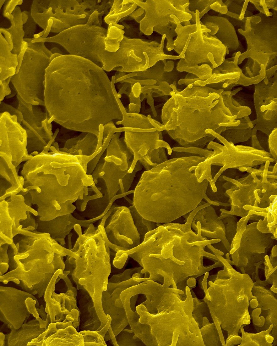 Activated platelets, SEM