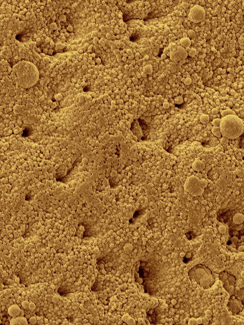 Chicken eggshell surface, SEM