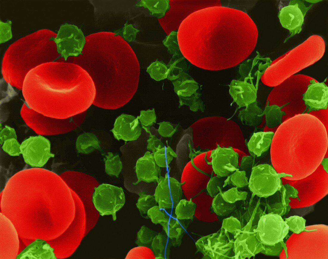 red-blood-cells-and-platelets-sem-acheter-une-photo-12310237