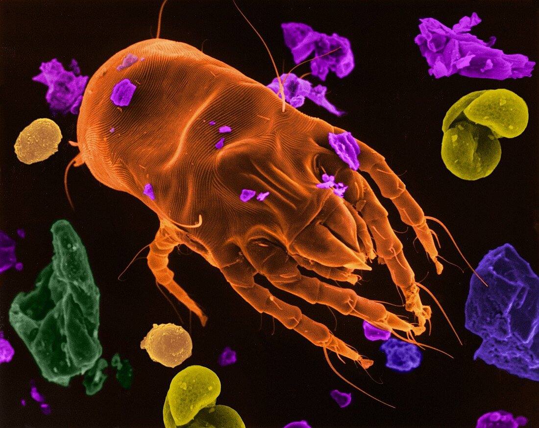 Dust mite (Dermatophagoides pteronyssinus), SEM