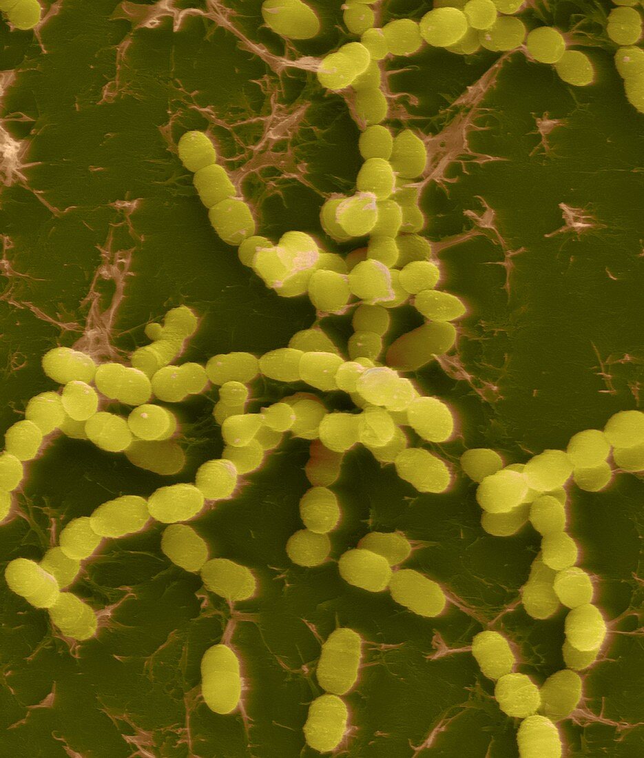 Streptococcus thermophilus, SEM