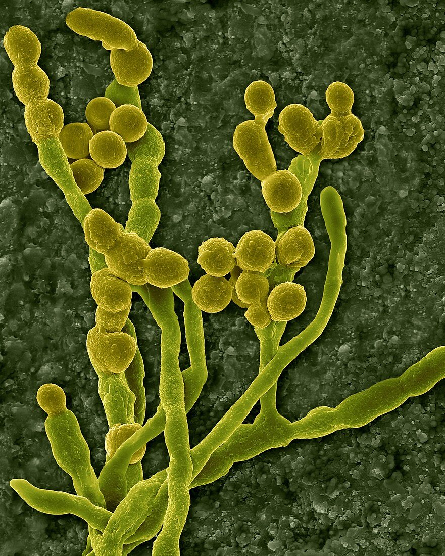 Mould (Cladosporium spp.) hyphae and spores, SEM
