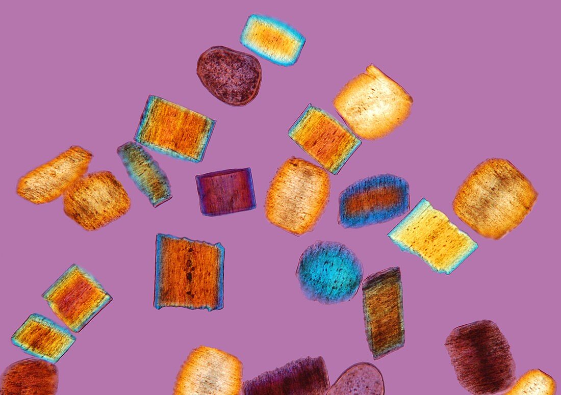 Beard hair shavings, polarised light micrograph