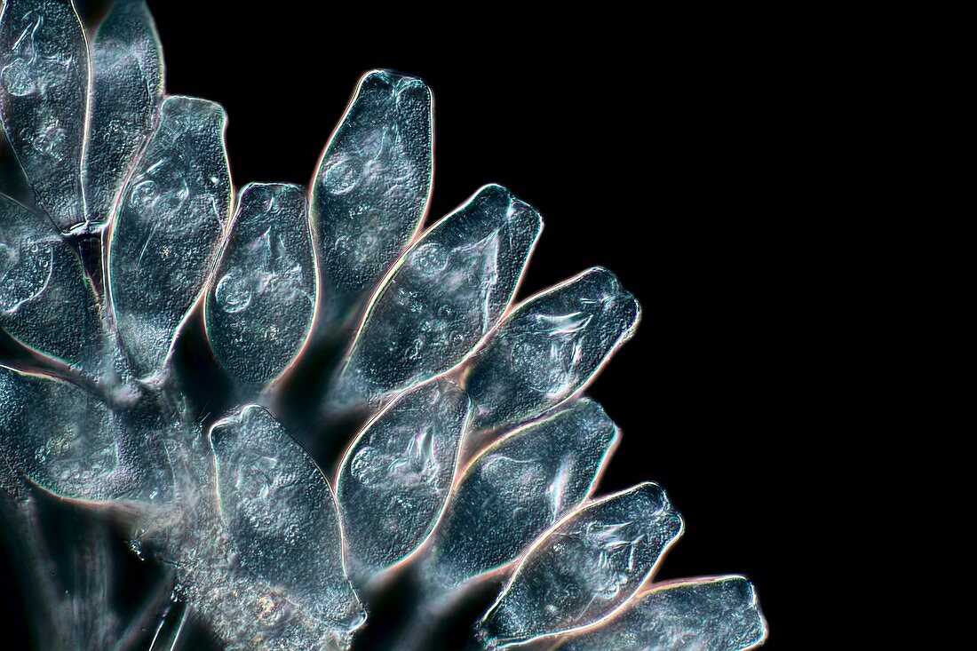 Vorticella protozoa, light micrograph
