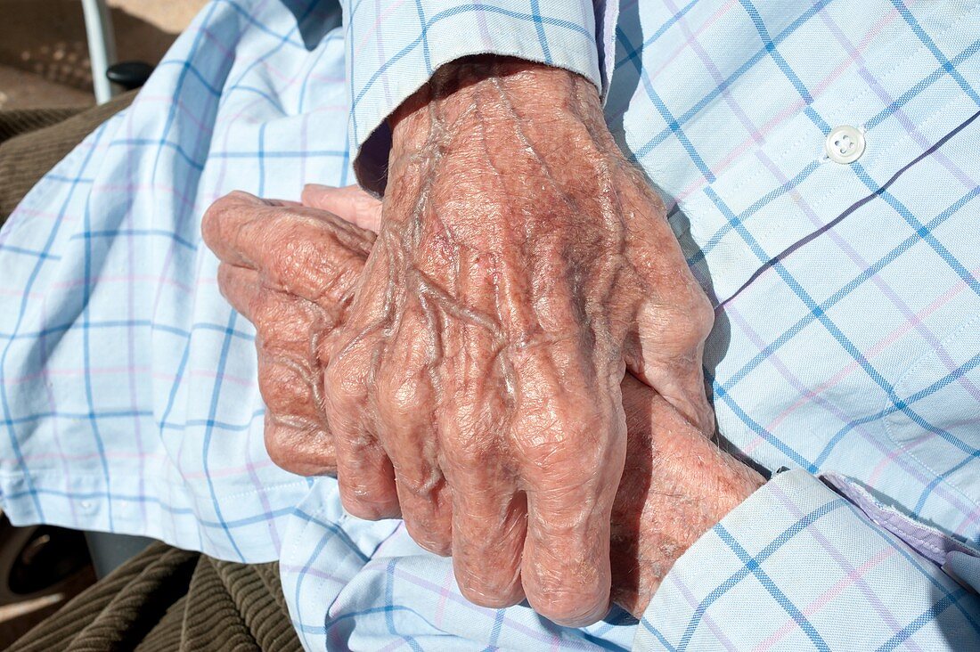 Elderly man's hands