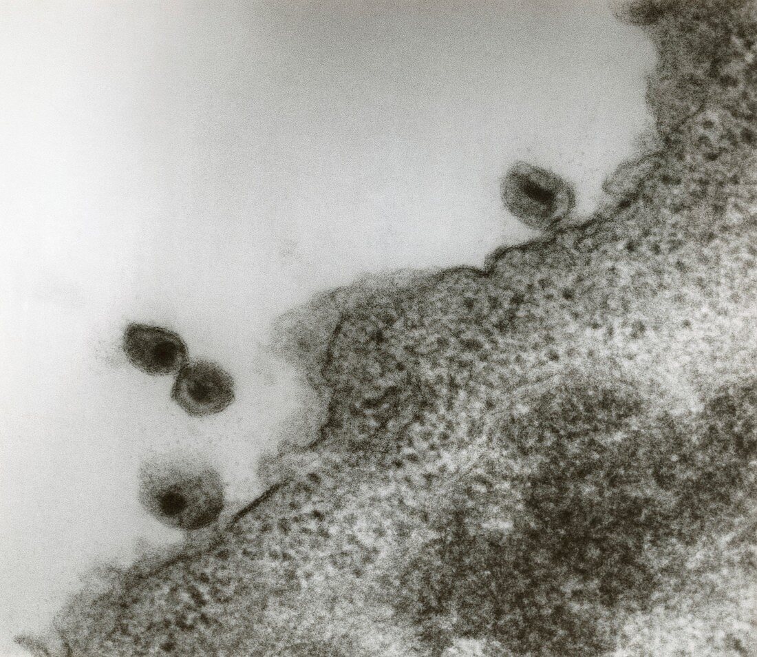 TEM of AIDS virus