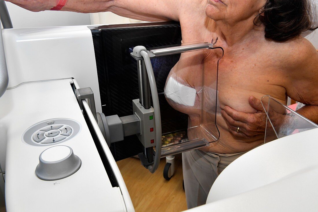 Mammography for breast cancer surgery