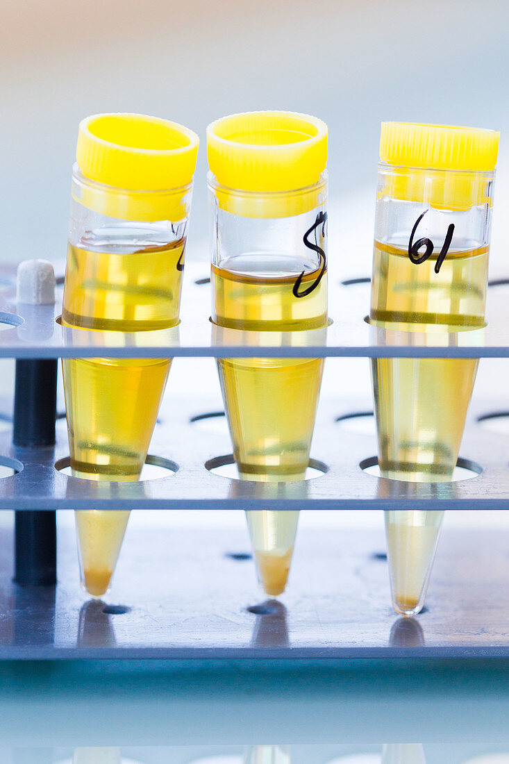 Urine analysis in laboratory