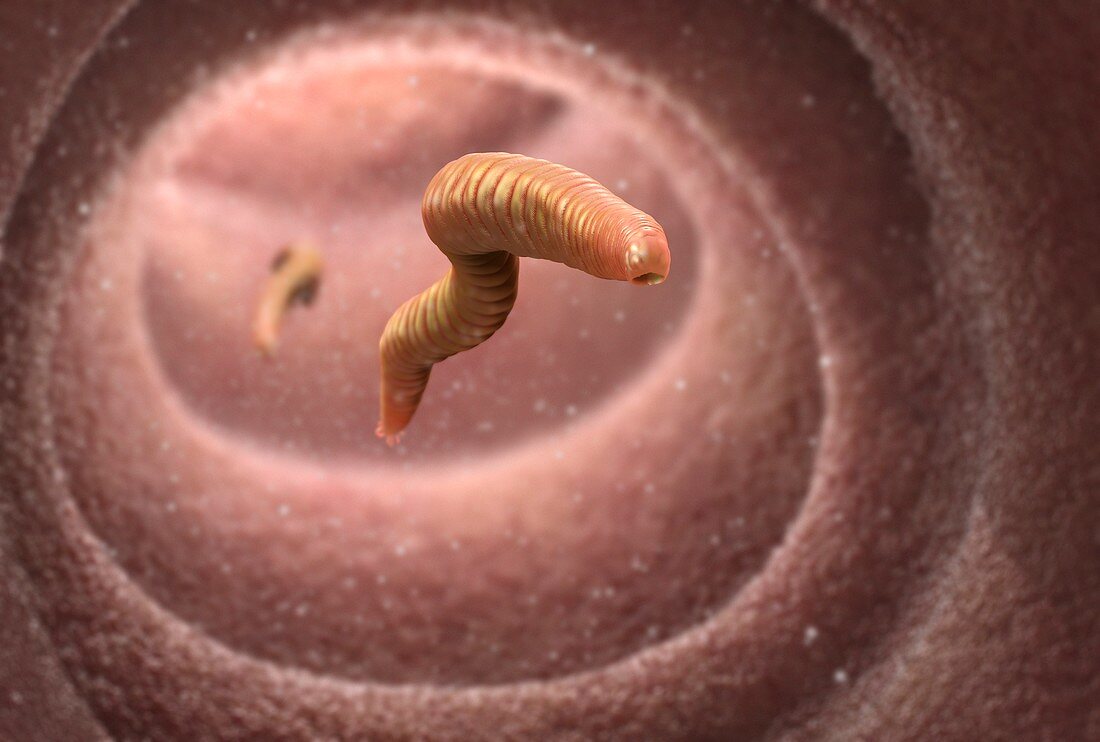 Hookworms in the intestine, illustration
