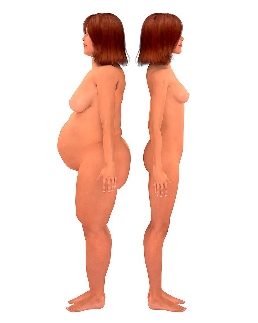 Overweight and healthy weight, illustration
