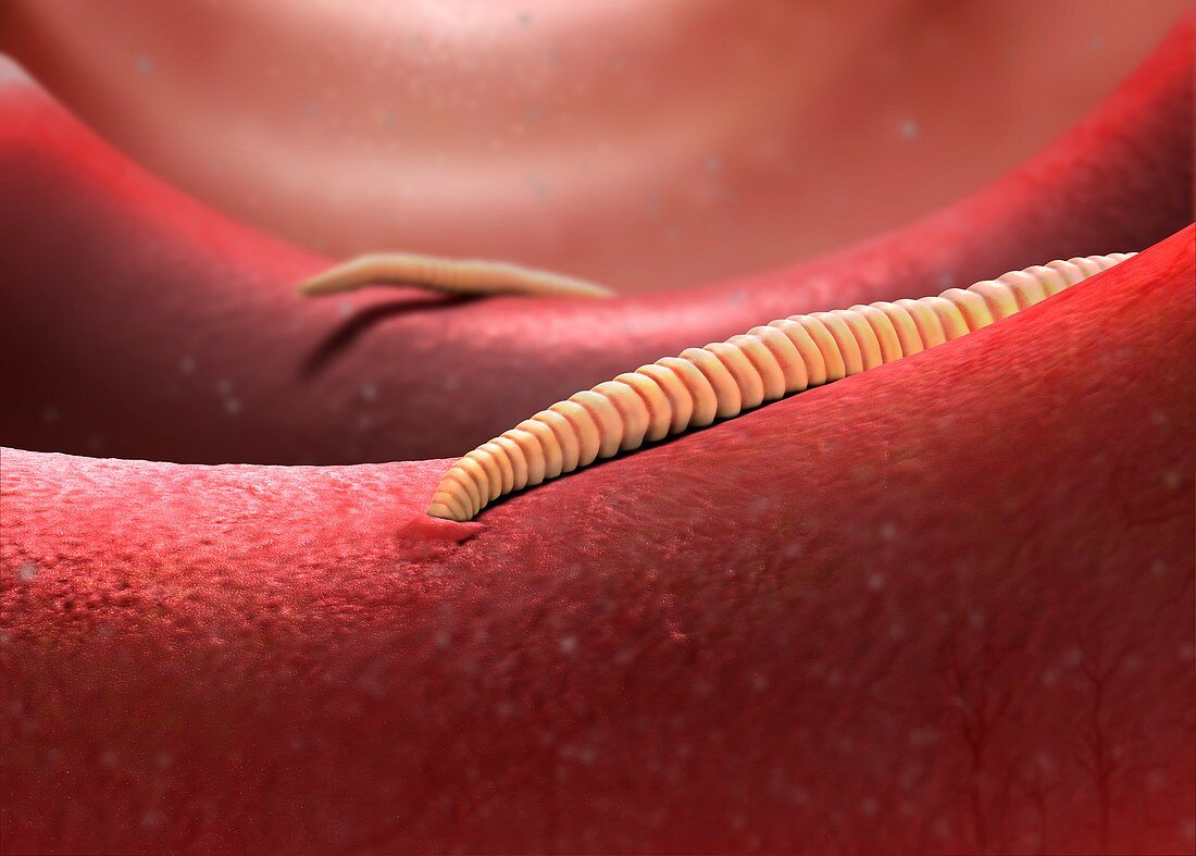 Hookworms in the intestine, illustration