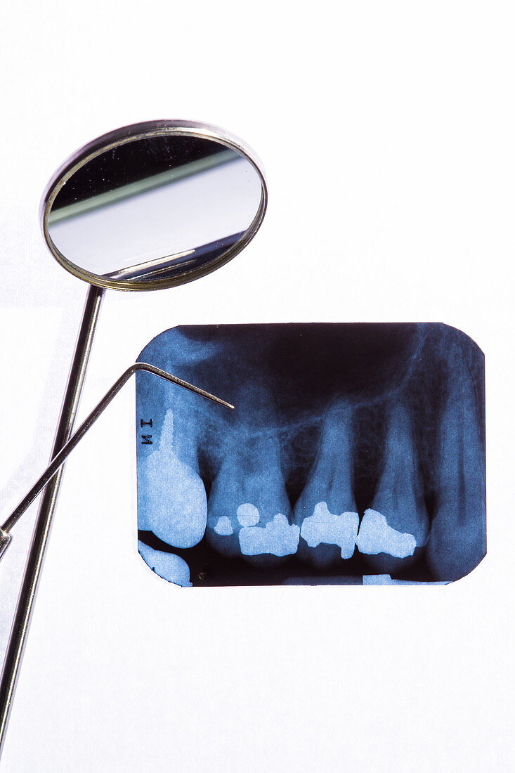 Teeth, X-ray