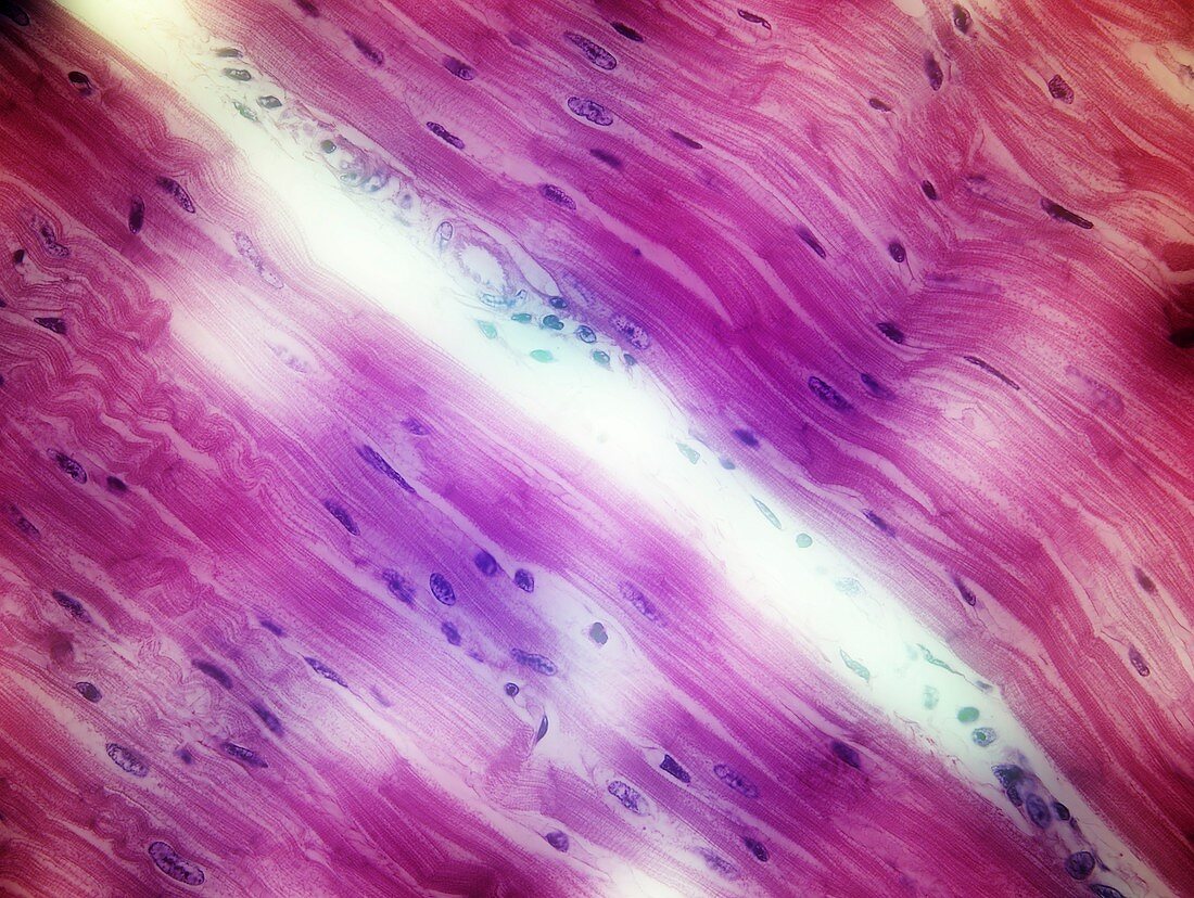 Cardiac muscle, light micrograph
