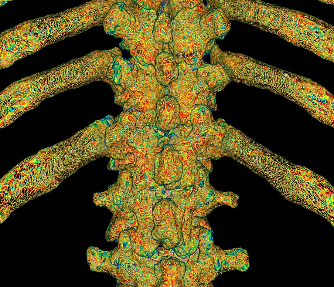 Thoracic spine anatomy, illustration